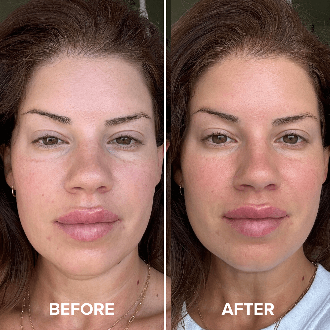 Complete Chill Hydration Set