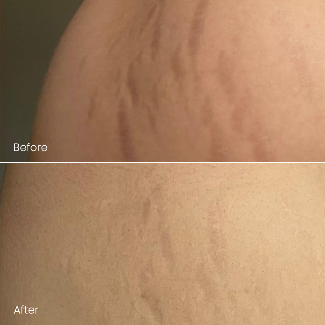 The Firming Duo Bundle